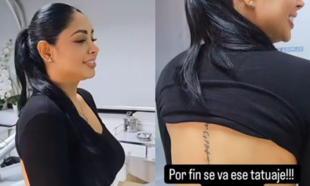 Decidida a borrar el pasado: Pamela Franco elimina tatuaje de Christian Domínguez
